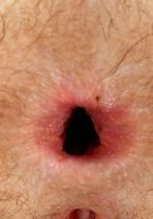 Amy fay spreads and gapes her hairy holes., Amy Faye (amy046) ATK Natural & Hairy: Amy Faye (Amy fay spreads and gapes her hairy holes.)