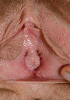Apricot Pitts in young and hairy, Apricot Pitts (apr024) ATK Natural & Hairy: Apricot Pitts (Apricot Pitts in young and hairy)