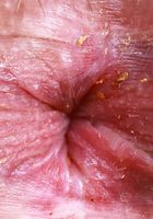 Aubry Babcock from ATK Exotics