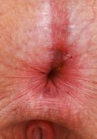 Bess Breast Strips out of Stripes, Bess Breast (bes004) ATK Natural & Hairy: Bess Breast (Bess Breast Strips out of Stripes)