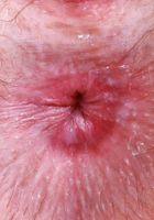 Big Eyes from ATK Natural & Hairy