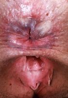 Dria Submits from ATK Natural & Hairy