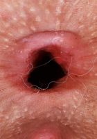 Evie gives a great look inside one of her gorgeous holes, Evie Christian (evi012) ATK Galleria: Evie Christian (Evie gives a great look inside one of her gorgeous holes)