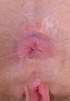Nickey gapes her big lipped hairy pussy., Nickey Huntsman (nic093) ATK Natural & Hairy: Nickey Huntsman (Nickey gapes her big lipped hairy pussy.)