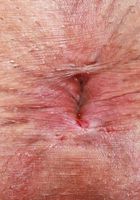 Penelope Reed Outdoors Spreads, Penelope Reed (pen027) ATK Petites: Penelope Reed (Penelope Reed Outdoors Spreads)