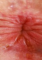 Stephanie Gwen Outdoor Nudity, Stephanie Gwen (ste079) ATK Galleria: Stephanie Gwen (Stephanie Gwen Outdoor Nudity)